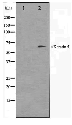 KRT5 / CK5 / Cytokeratin 5 Antibody