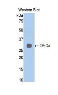 CTSD / Cathepsin D Antibody (aa169-408)