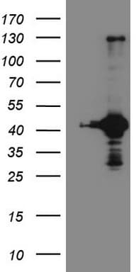 RPS6KC1 Antibody (aa1-305, clone OTI10F11)