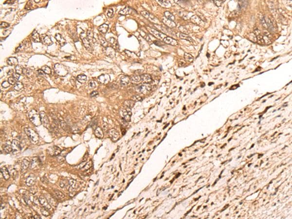 MAGEA1 / MAGE 1 Antibody
