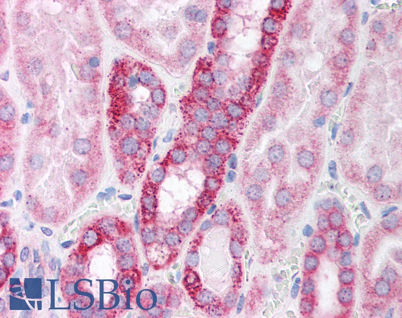 Polyclonal Rabbit anti-Human POLR2B / RPB2 Antibody (aa805-854, IHC, WB)