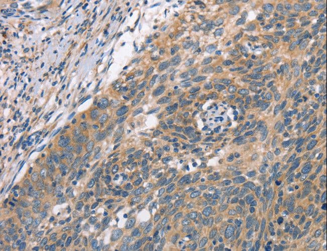 PLEKHO1 / CKIP-1 Antibody