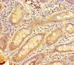 Polyclonal Rabbit anti-Human TMPRSS11D / HAT Antibody