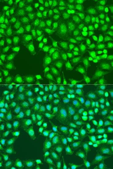 Polyclonal Rabbit anti-Rat DEFB126 Antibody (IF)