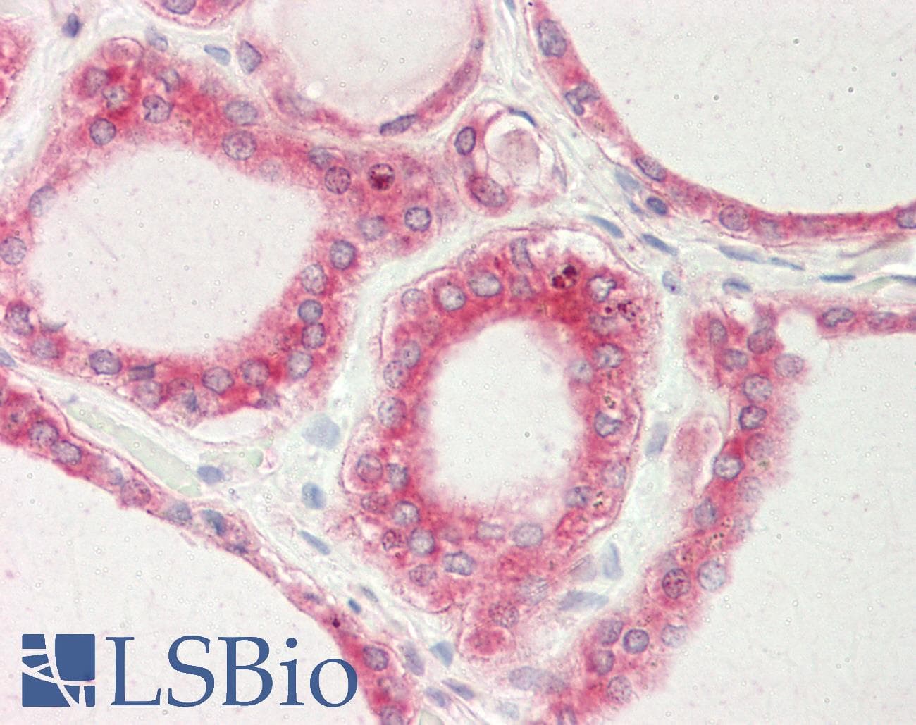 IHC-plus™ GOK / STIM1 Antibody (N-Terminus)