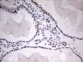 TOP2A / Topoisomerase II Alpha Antibody (aa1100-1531, clone OTI5E6, Carrier-free)