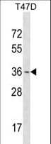 Polyclonal Rabbit anti-Human OTX1 Antibody (aa87-116, WB)