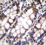IHC-plus™ UQCRFS1 Antibody (aa181-209)