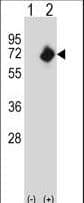 NMT2 Antibody (aa125-153)