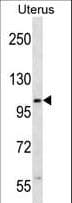 ZSWIM5 Antibody (aa63-92)