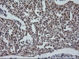 ETS2 Antibody (aa90-349, clone OTI2A3, Carrier-free)