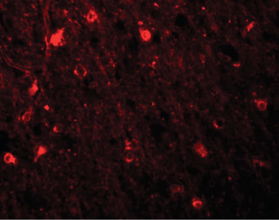 IHC-plus™ E6TP1 / SIPA1L1 Antibody