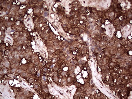 PKM2 Antibody (clone 1G10)