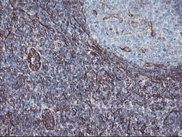 KIF2C / MCAK Antibody (clone OTI1C5)
