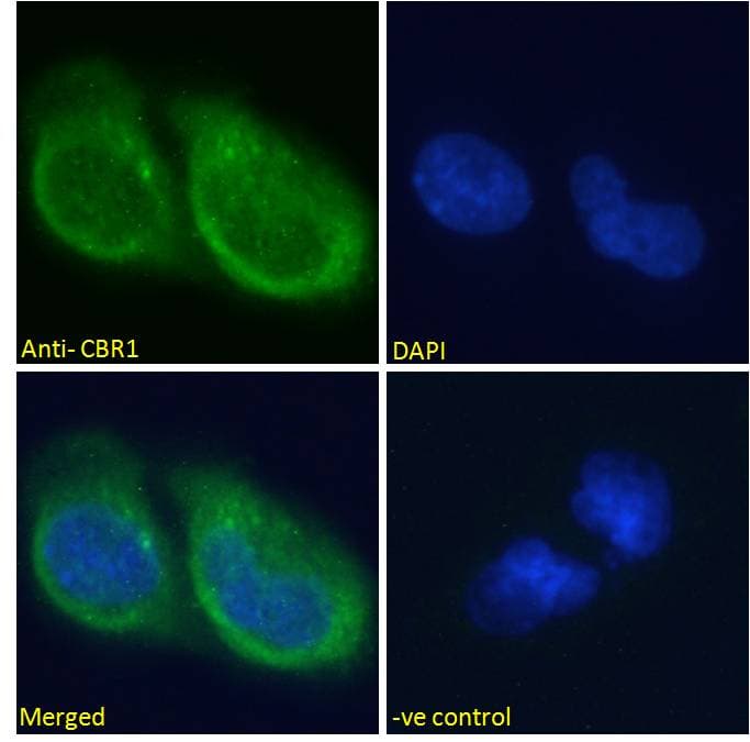 IHC-plus™ CBR / CBR1 Antibody (aa265-277)