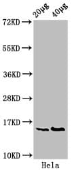 HIST1H3A Antibody (phospho-Ser10)