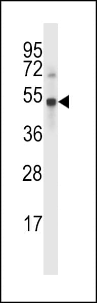Polyclonal Rabbit anti-Human USP46 Antibody (aa241-269, WB)