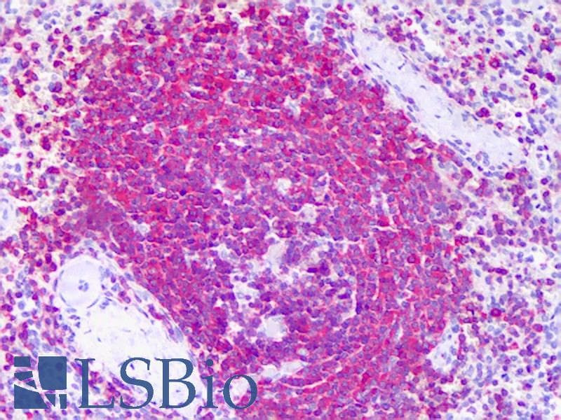 IHC-plus™ Monoclonal Mouse anti-Human RICTOR Antibody (clone 1F3, IHC, WB)