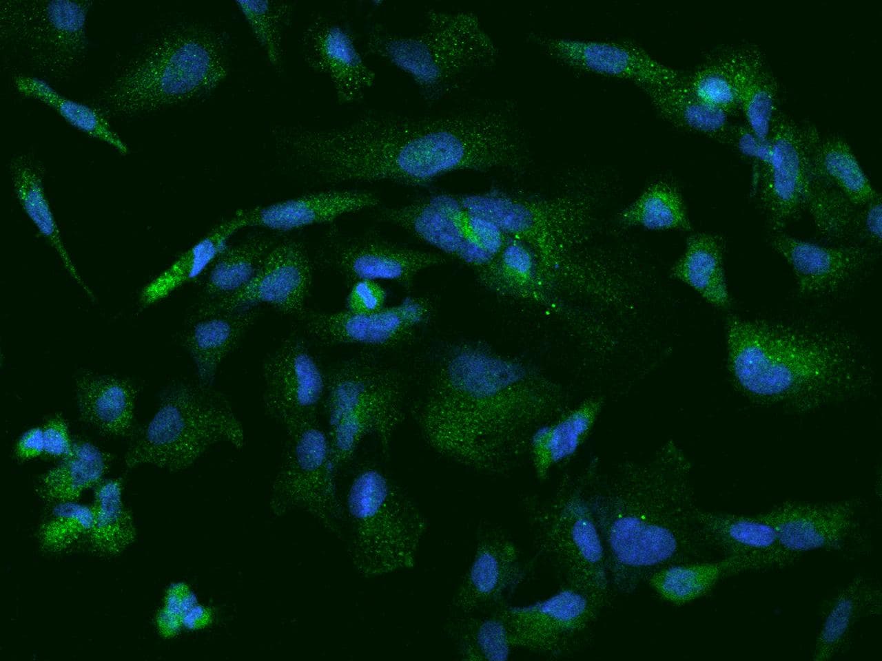 ARHGEF6 Antibody