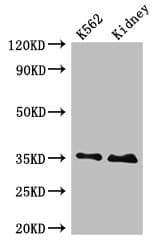 Polyclonal Rabbit anti-Human TRADD Antibody (IHC, IF, WB)