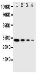 LTK Antibody (aa850-864)
