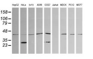 PARVA Antibody (clone OTI1H2, Carrier-free)