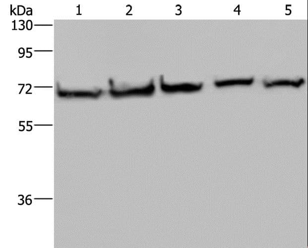 HSPA9 / Mortalin / GRP75 Antibody