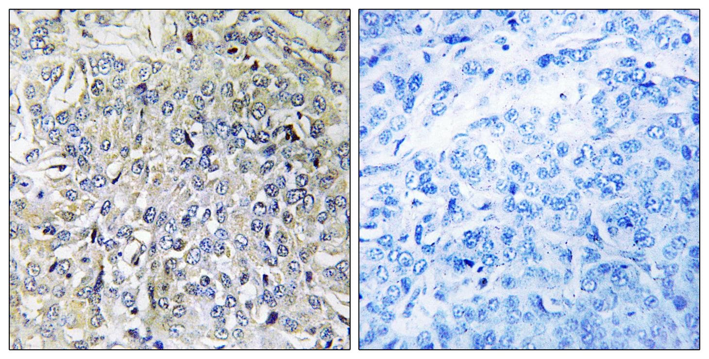 CSGALNACT2 Antibody