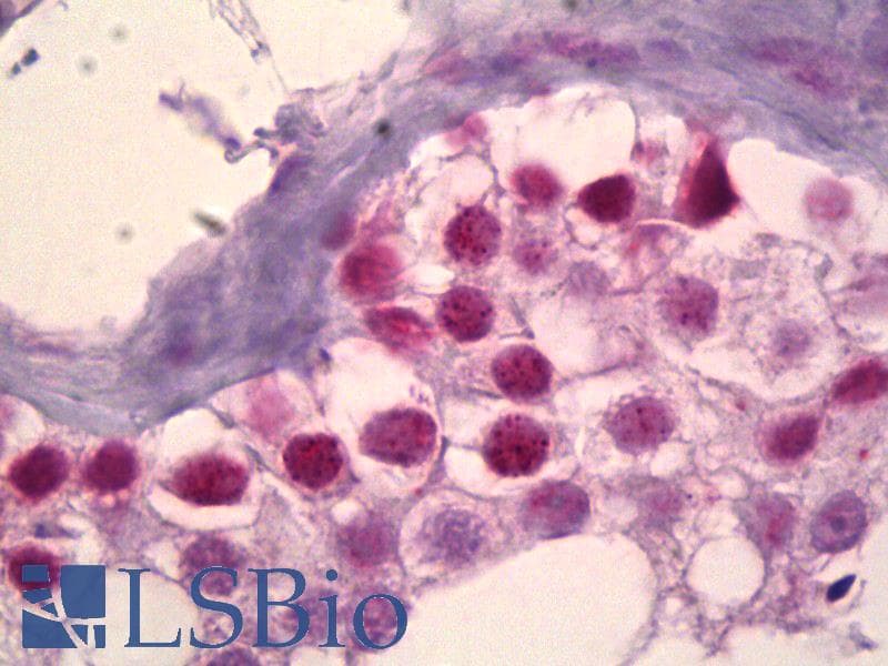 IHC-plus™ Monoclonal Mouse anti-Human RPS6KA5 / MSK1 Antibody (clone 1G7, IHC)