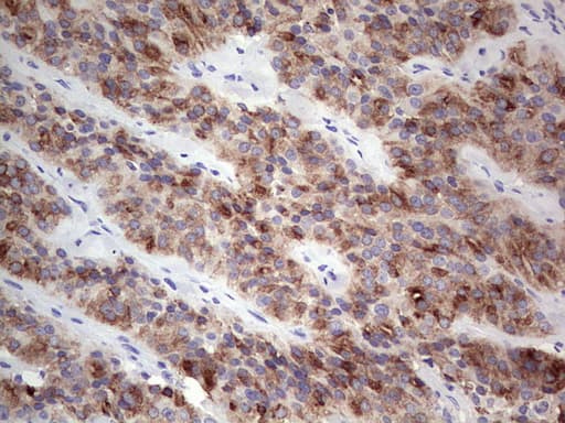 Monoclonal Mouse anti-Human TG / Thyroglobulin Antibody (clone OTI15F1, aa20-358, IHC)