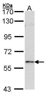 IHC-plus™ Polyclonal Rabbit anti-Human FOXN1 Antibody (IHC, WB)