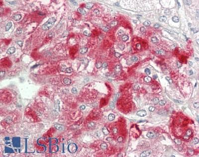 IHC-plus™ VTI1B Antibody
