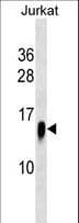 Polyclonal Rabbit anti-Human ATP6V1F Antibody (aa82-111, WB)