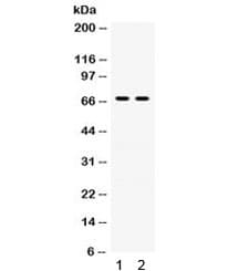 IVL / Involucrin Antibody