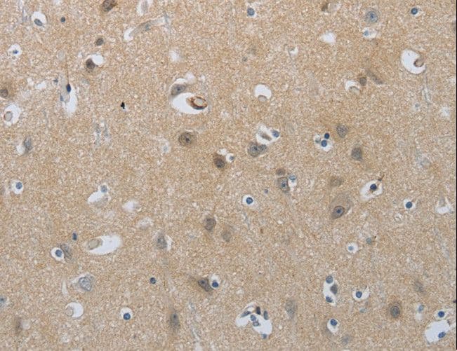 Polyclonal Rabbit anti-Human NPRA / NPR1 Antibody (IHC)