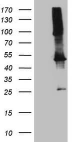 TWF1 / PTK9 Antibody (aa140-384, clone OTI6C11)
