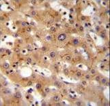Polyclonal Rabbit anti-Human GGCX Antibody (aa548-578, IHC, WB)
