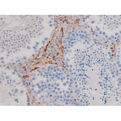 AKT1 Antibody (phospho-Ser124)