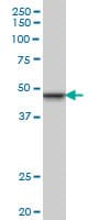 IHC-plus™ Monoclonal Mouse anti-Human SMARCB1 / INI1 Antibody (clone 3E10, IHC, WB)