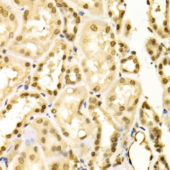 Polyclonal Rabbit anti-Human MAPK3 / ERK1 Antibody (IHC, IF, WB)