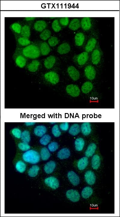 Polyclonal Rabbit anti-Human CCNT2 / Cyclin T2 Antibody (aa497-730, IHC, WB)