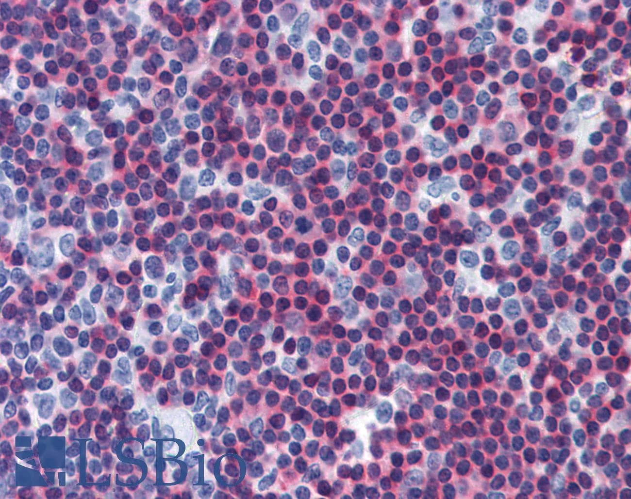 IHC-plus™ CAMK4 / CaMK IV Antibody (clone 1A3)