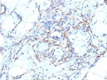 SMMHC / MYH11 Antibody (clone MYH11/923 + SMMS-1, Ready-to-Use)