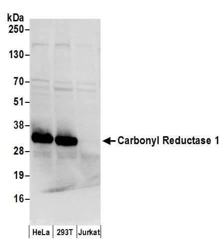 CBR / CBR1 Antibody (aa227-277)