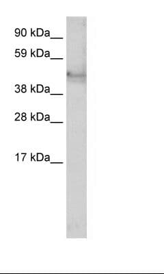 KRT14 / CK14 / Cytokeratin 14 Antibody (C-Terminus)