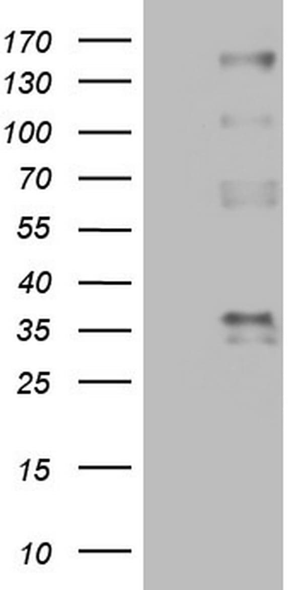 PROCR / EPCR Antibody (aa1-210, clone OTI1G8)
