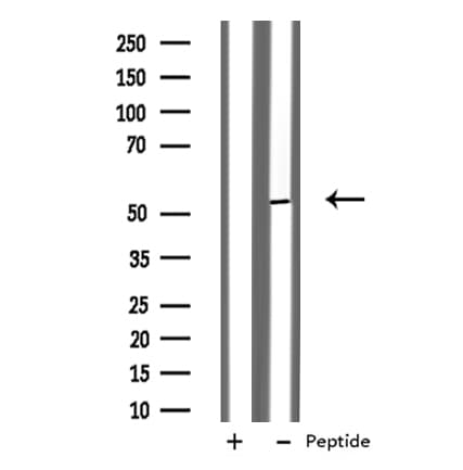 SYNCAM / CADM1 Antibody