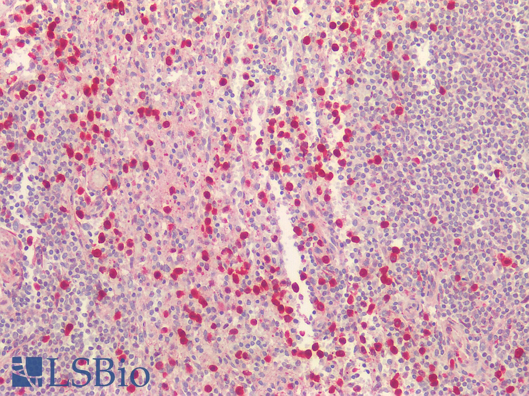 ORAOV1 Antibody