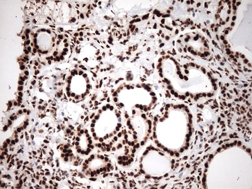 TRIM28 / KAP1 Antibody (clone OTI2H10, Carrier-free)