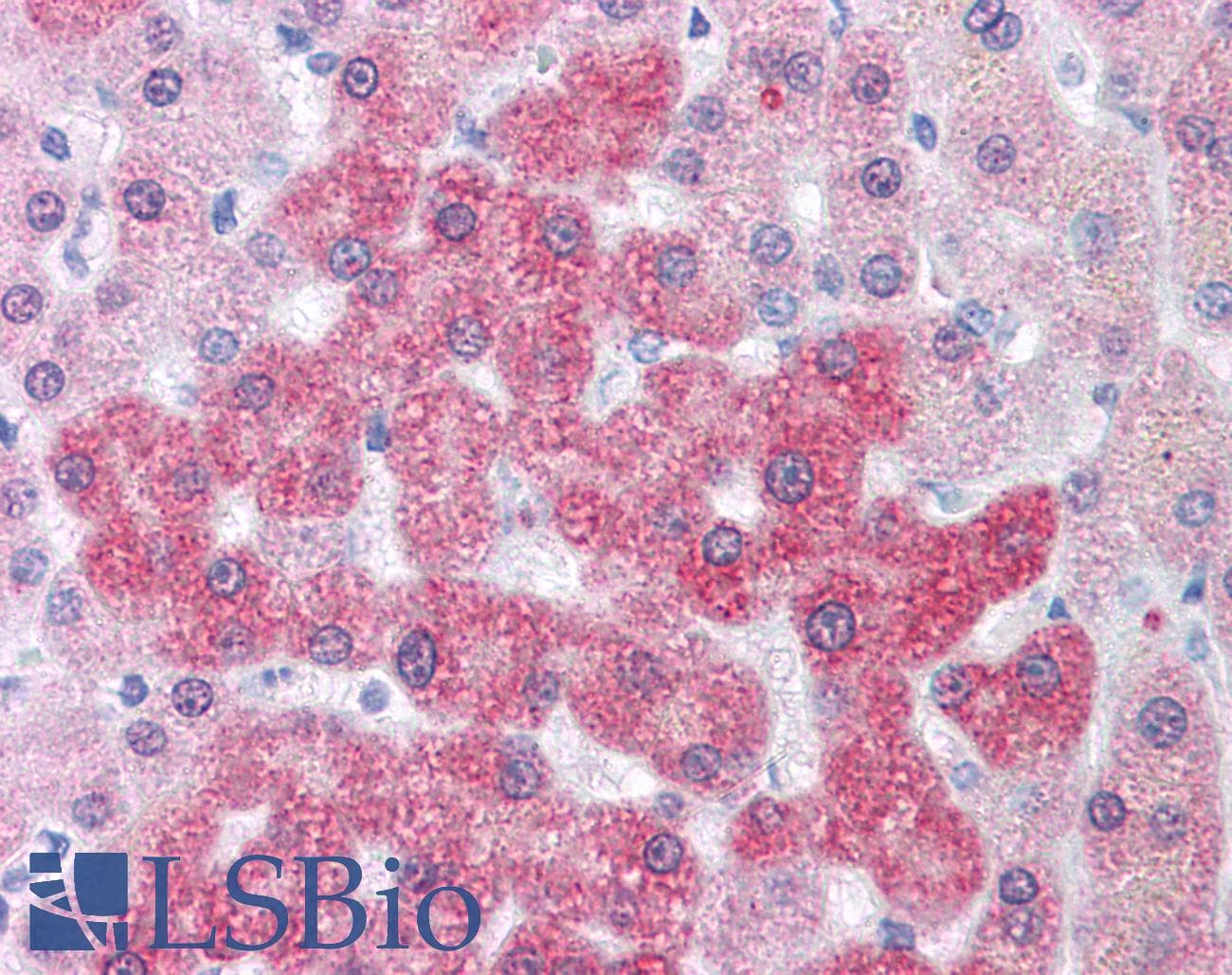 IHC-plus™ Polyclonal Rabbit anti-Human LOXL2 Antibody (Internal, IHC)